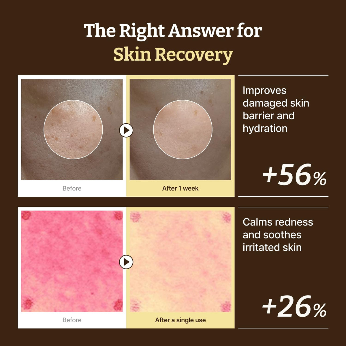 Advanced PDRN Rejuvenating Cream (Secret Deal)