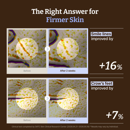 The Curated Essentials Bundle: PDRN Copper Peptide Serum + PDRN Cream + LC-Ceramide Barrier Cream + PDRN Mask